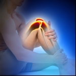 Stem Cell Therapy For An ACL Tear - New York